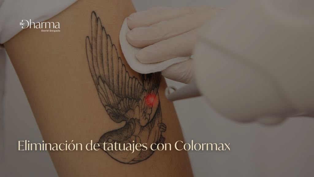 Eliminación de tatuajes con Colormax en Medellín - Clínica Be Dharma en Medellín - Láser Colormax - ¿Cómo eliminar tatuajes