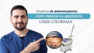 Cicatrices de abdominoplastia