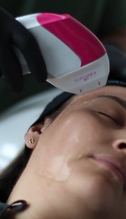 facial rejuvenation treatments Ultraformer - Be Dharma clinic