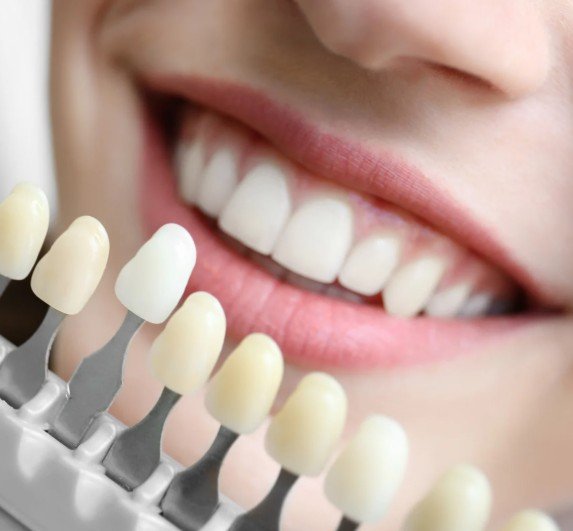 Diseño de sonrisa en Medellín - Clínica Be Dharma - Be Dharma Dental