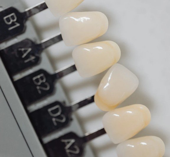 Microdiseño de sonrisa en Medellín - Clínica Be Dharma - Be Dharma Dental