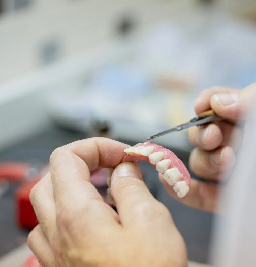 Prótesis dental en Medellín - Clínica Be Dharma - Be Dharma Dental 2