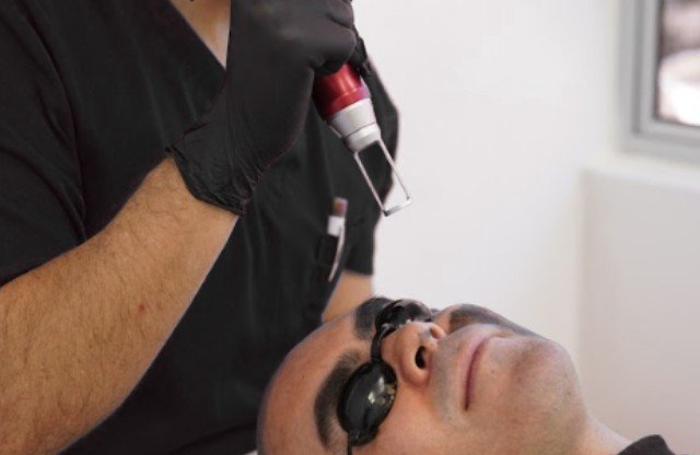 Qué sirve para las manchas en la cara - Láser Colormax - Clínica estética Be Dharma de Medellín