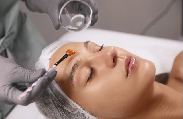 Qué sirve para las manchas en la cara - Peeling químico - Clínica estética Be Dharma de Medellín