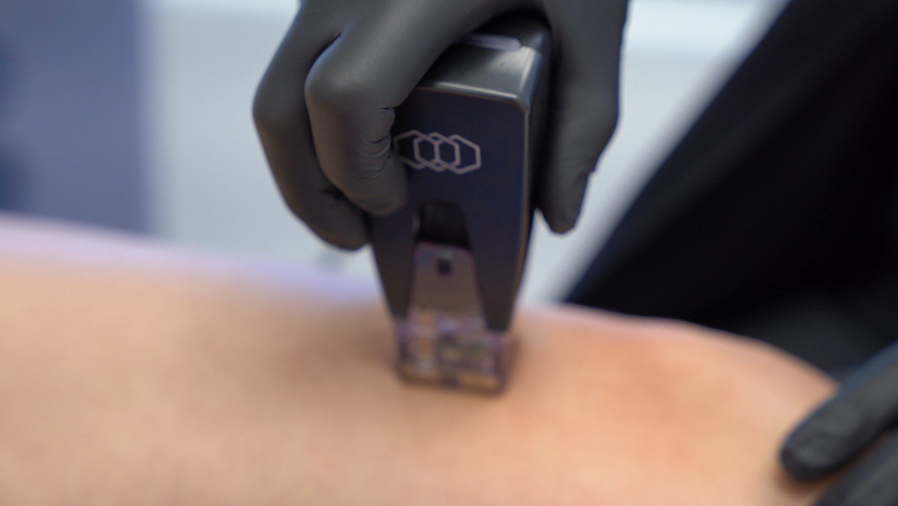 Rejuvenecimiento facial-Clínica Be Dharma-Morpheus