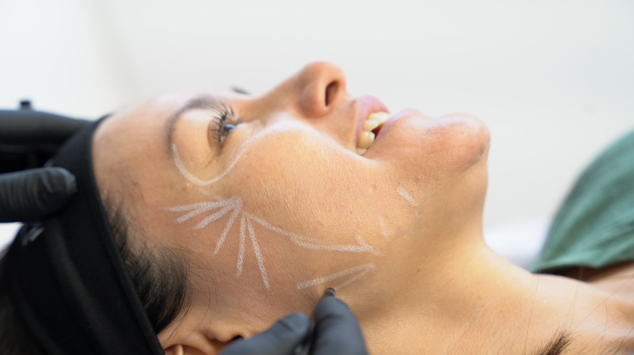 Rejuvenecimiento facial-Clínica Be Dharma
