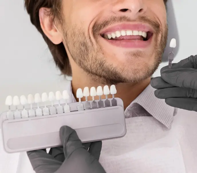 Blanqueamiento dental cerca a mí en Medellín - Clínica odontológica Be Dharma Dental