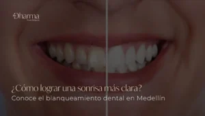 Blanqueamiento dental en Medellín, Colombia, en la clínica de odontología estética Be Dharma Dental