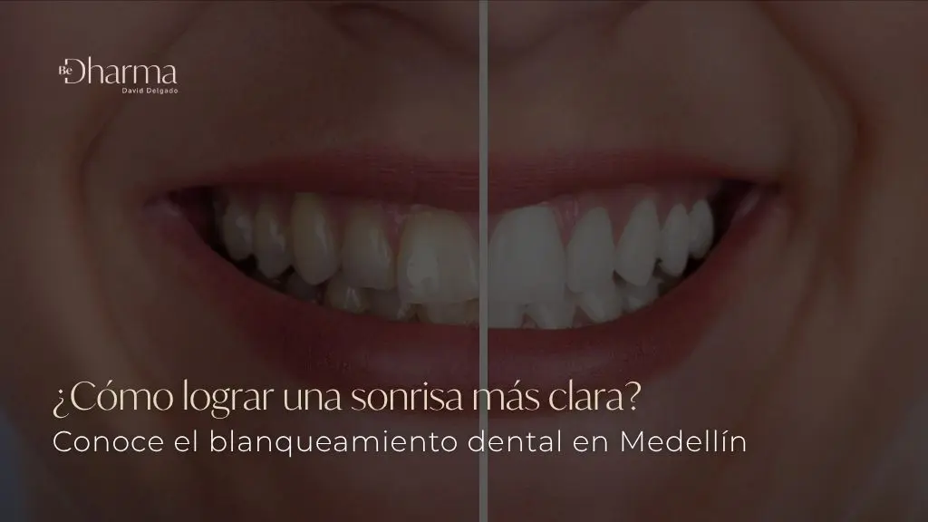 Blanqueamiento dental en Medellín, Colombia, en la clínica de odontología estética Be Dharma Dental