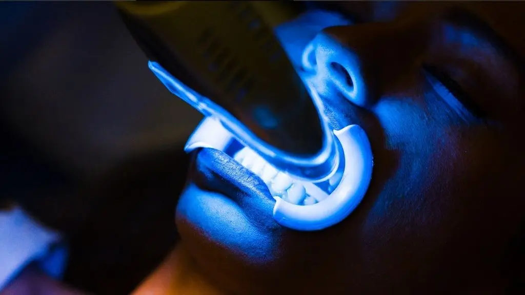 Blanqueamiento dental láser en Medellín - Clínica odontológica Be Dharma Dental