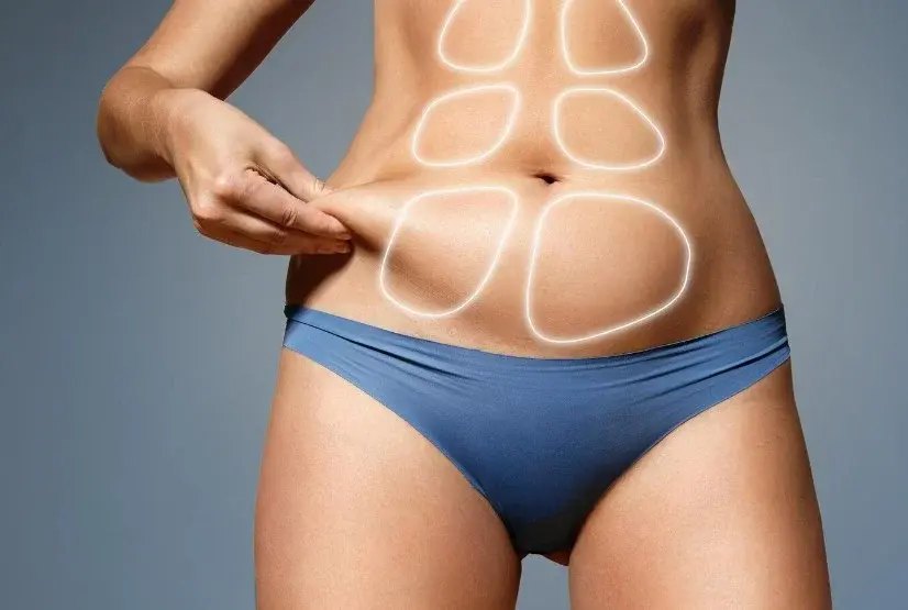 Grasa abdominal que no se va-Clínica Be Dharma