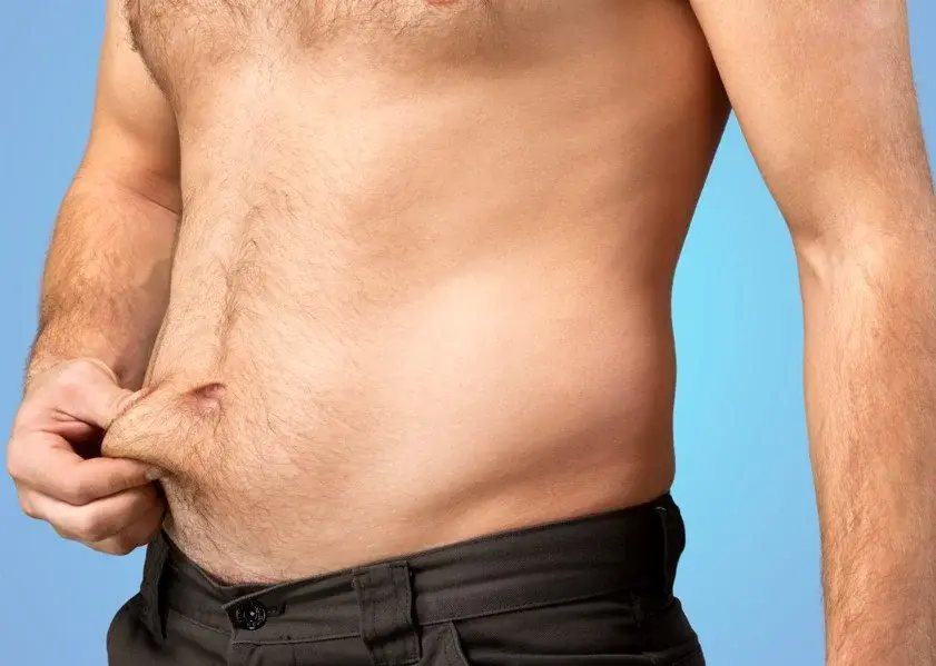 Grasa abdominal que no se va-Clínica Be Dharma