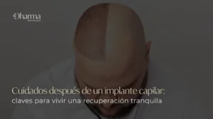 Cuidados después de un implante capilar- Clínica Be Dharma