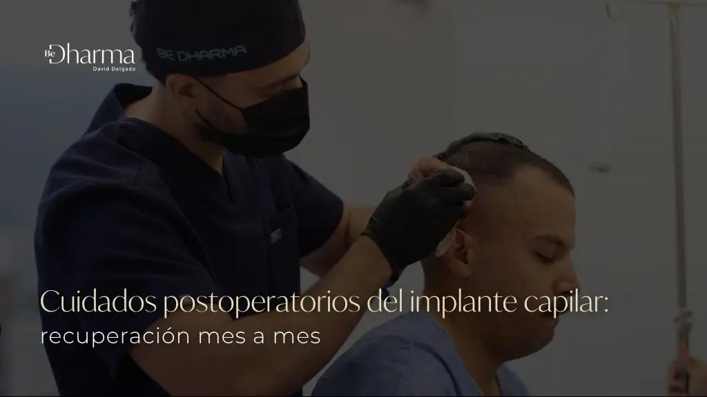 Recuperación y cuidados de un implante capilar mes a mes en Medellín, Colombia - clínica estética Be Dharma - Clínica de implante capilar Be Dharma Hair