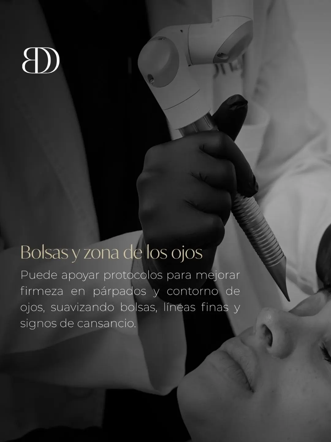 Láser fotona en Medellín - Blefaroplastia sin cirugía - clínica estética Be Dharma