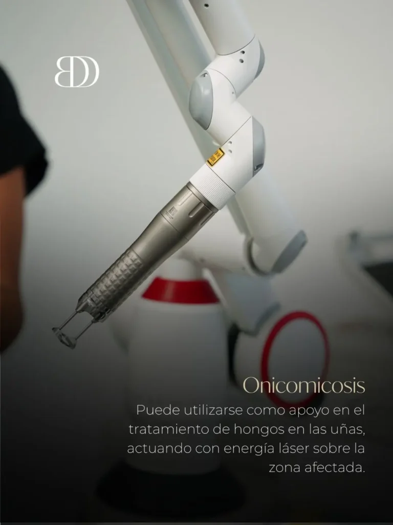 Láser fotona en Medellín - Tratamiento para la onicomicosis - clínica estética Be Dharma