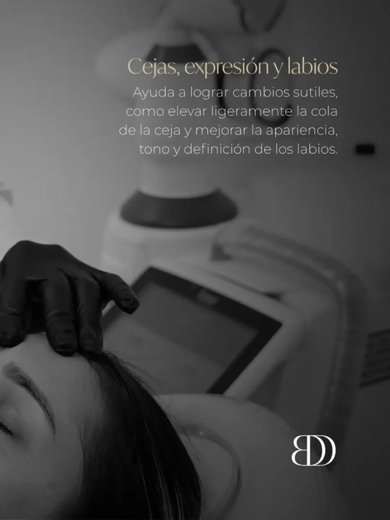 Láser fotona en Medellín - levantamiento de cejas e hidratación de labios - clínica estética Be Dharma