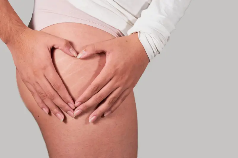 Tratamiento para la celulitis-Clínica Be Dharma en Medellín