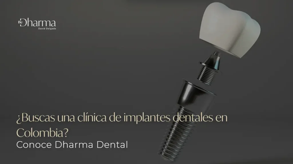 Clínica de implantes dentales- Clínica Be Dharma- Dharma Dental