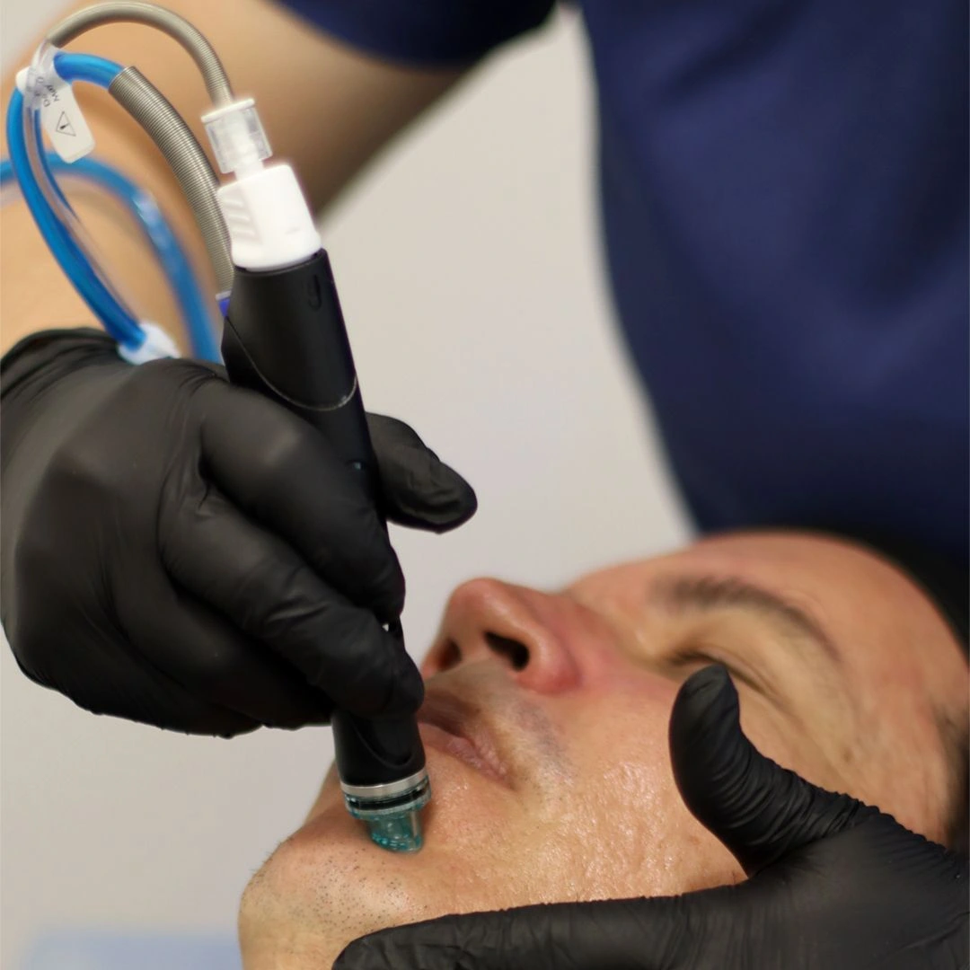 Clínica dermatologica en medellín - Hydrafacial - Be Dharma - Medellín (2)