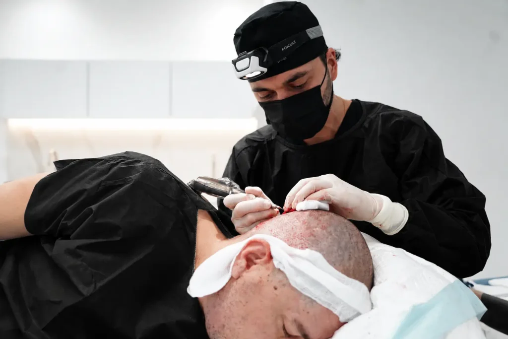 Hair Transplant in Medellin- Clínica Be Dharma Medellín