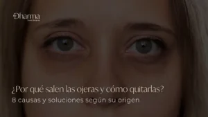 Por qué salen las ojeras y cómo quitarlas - Clínica BeDharma - Medellín, Colombia