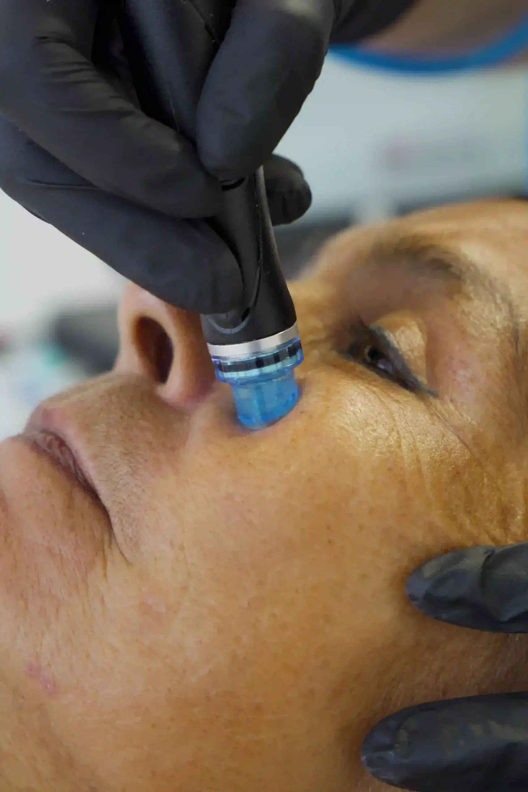 Korean Skincare in Medellín- Be Dharma Clinic- Estetic Clinic in Medellín-Before and after