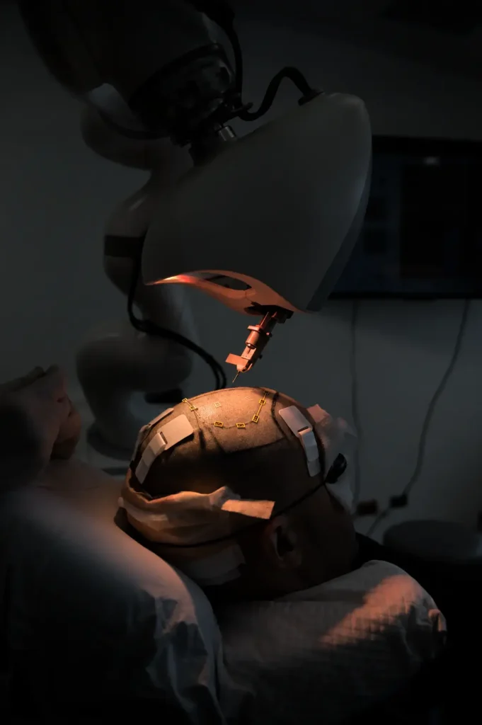 Trasplante capilar robótico en Clínica Be Dharma - Medellín, Colombia